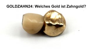 Welches Gold ist Zahngold?