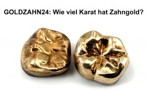 Wie viel Karat hat Zahngold